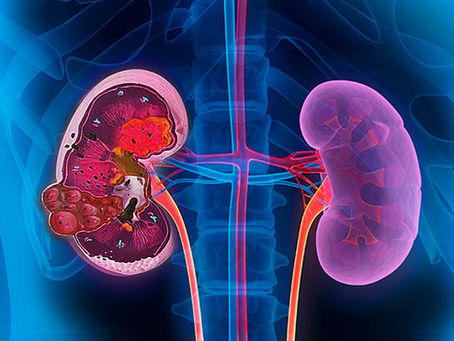 Chữa suy thận và phục hồi thận