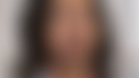 Franyutti joins Hamilton Wound and Hyperbaric Services