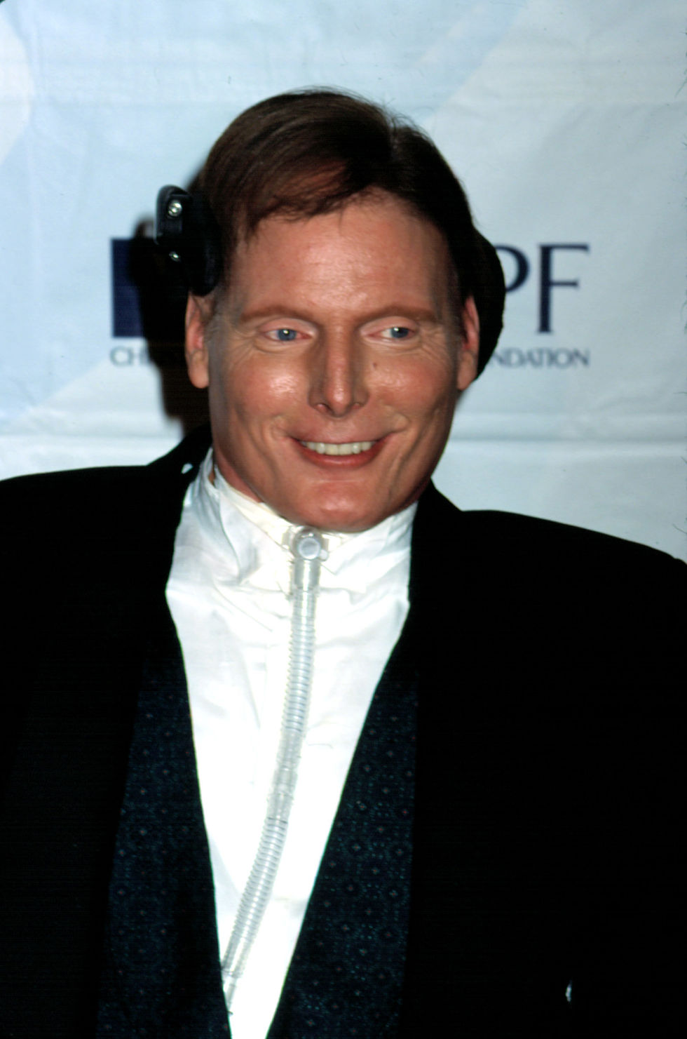 A man in a suit smiles warmly. He has a breathing tube attached.