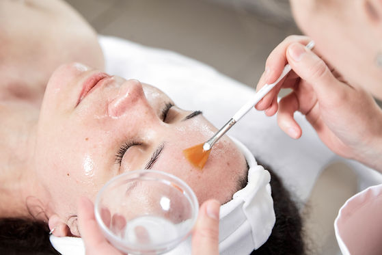 Chemical Peels in Langley