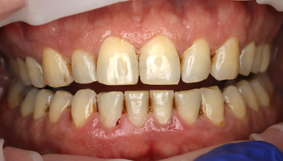 Ben choi periodontist periodontal diseas
