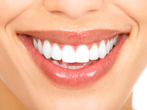 Clareamento Dental: Tudo o Que Você Precisa Saber