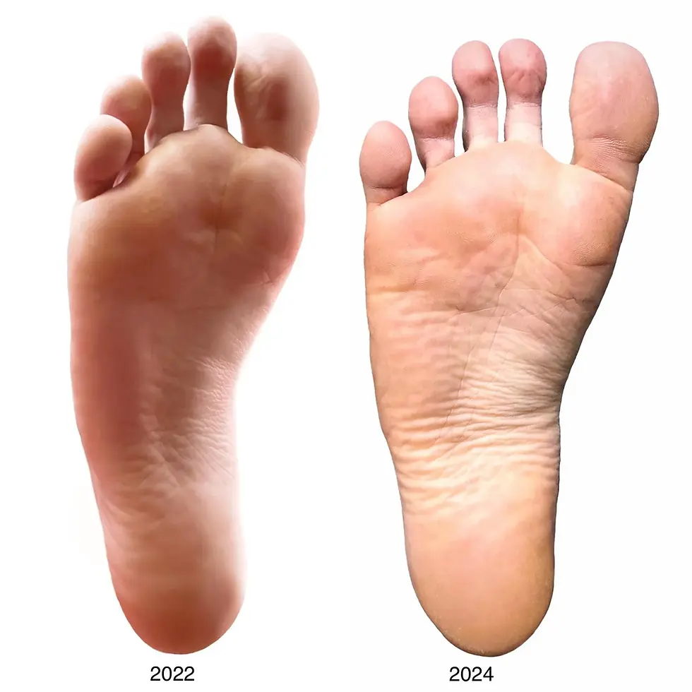 A natural foot when spread out without conventional footwear, but through barefoot walking and barefoot shoes