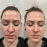 Seattle Bellevue Bothell Kirkland Lynnwood Fluffy Microblading Combo Hybrid Powder Ombre Microshading Brows