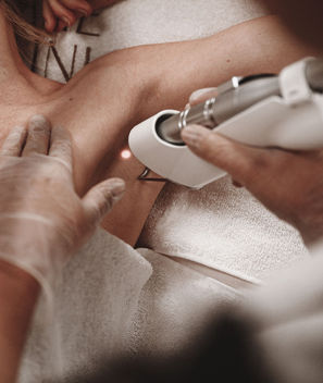 10 feiten en fabels over laserontharing