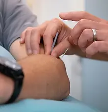 acupuncture physiotherapy treatment