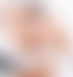 The Magic of Chemical Peels by Dermaletic Skin Clinic