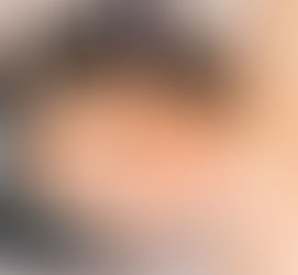 Rediscover Radiant Skin with Micro-Needling Treatment at Dermaletic Clinic