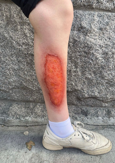 special effects, gore, scary, film, television, spfx, sfx, eczema, fake, makeup artist, makeup, art