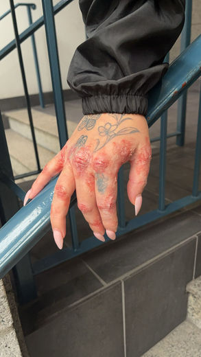 special effects, gore, scary, film, television, spfx, sfx, eczema, fake, makeup artist, makeup, art