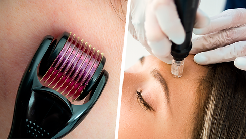 Micro-needling image.png