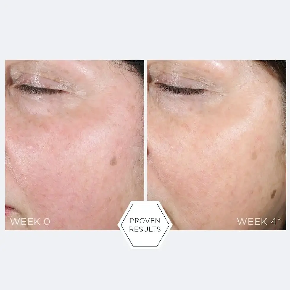 Miniatyrbilde: Neostrata Restore PHA Renewal Pads 60 stk 55ml