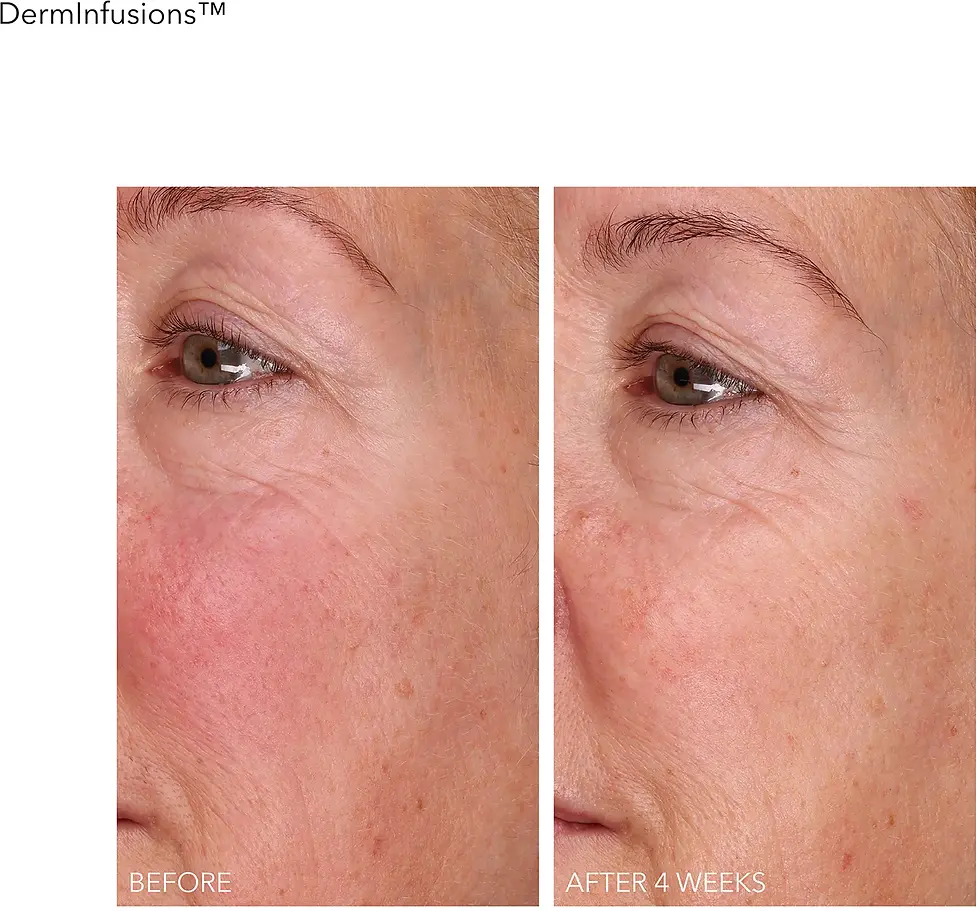 Miniatyrbilde: Dr Dennis Gross DermInfusions Fill + Repair Serum 30 ml