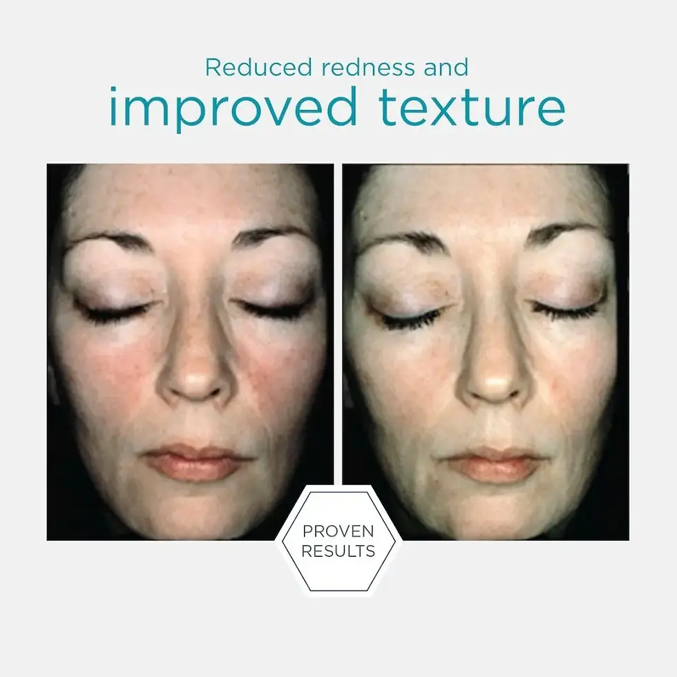 Miniatyrbilde: Neostrata Restore Bionic Face Cream 40g