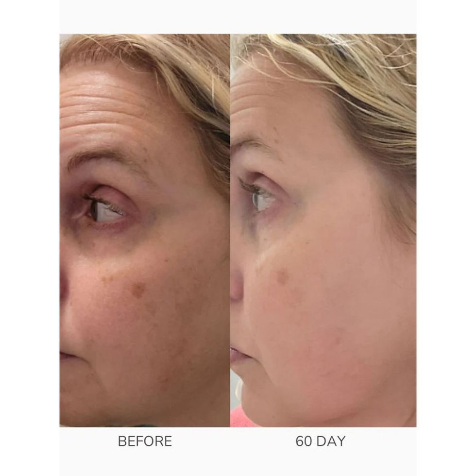 Miniatyrbilde: Emani Sleep & Renew Serum-Microbiotisk antirynke serum