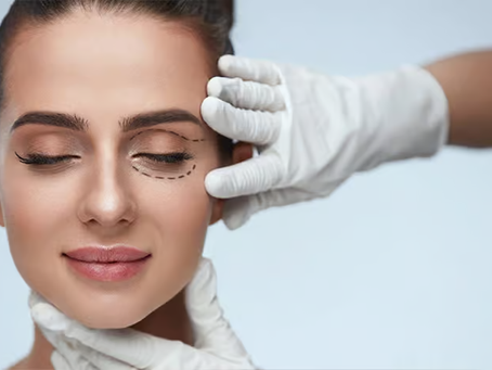 Blepharoplasty Dubai
