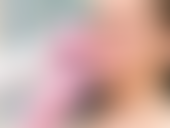 Russian Lip Filler in Dubai