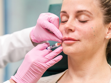 Russian Lip Filler in Dubai