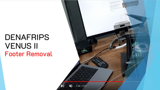 Guide to remove DENAFRIPS Venus II footers