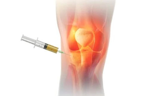 PRP injections for knee in Dubai, UAE