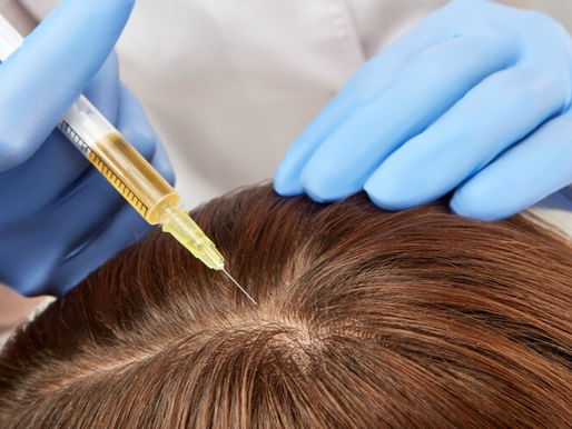 PRP Hair Treatment in Mumbai