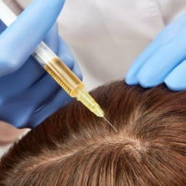 PRP Hair Treatment in Mumbai – Dr. Niketa Sonavane