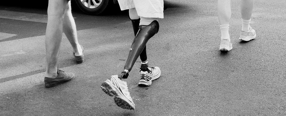 Urban Street Scene with Prosthetic Limb