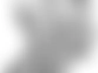 Bells Palsy