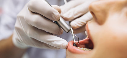 K Family Dentistry in Pflugerville, TX 78660 Emergency, Invisalign, Family, Cosmetic - Laser dentistry, Dental Implants, Crowns, Bridges, Restorations, Veneers, Fillings, Root Canal Therapy, ClearCorrect, Dentures, Teeth Whitening, Inlays and Onlays, Sedation Dentistry, Emergency Dentist, Kid Friendly Dentist, Dental Checkup, Cleaning & Examinations