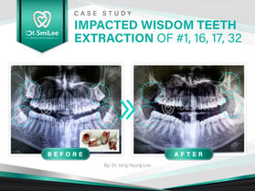 GMedia Dental Marketing & Web Design in Dallas, Fortworth - ad campaign, brand identity, brand management, business card, digital marketing, email marketing, inbound marketing, local seo, logo design, marketing campaigns, printing design, search engine optimization, social media management, social media marketing, web design, web design agencies, marketing strategy, content marketing, best digital marketing agencies, top digital marketing company, dental marketing