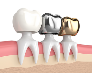 Altamesa Dental Fort Worth, TX 76133 Family, Emergency, Implants - Dental Implants, Dental Crowns, Bridges, Dental Fillings, Dentures, Invisalign, Smile Makeover, Tooth Extraction, ClearCorrect, Teeth Whitening, Porcelain Veneers, Tooth Bonding, Kid Friendly Dentist, Inlays and Onlays, Periodontics, Periodontal Therapy, Dental Checkup, Cleaning & Examinations, Root Canal Therapy, Toothaches, Dental Emergency