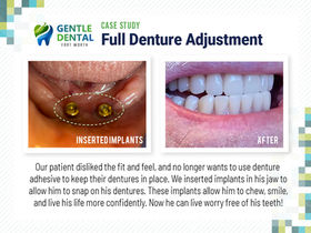 GMedia Dental Marketing & Web Design in Dallas, Fortworth - ad campaign, brand identity, brand management, business card, digital marketing, email marketing, inbound marketing, local seo, logo design, marketing campaigns, printing design, search engine optimization, social media management, social media marketing, web design, web design agencies, marketing strategy, content marketing, best digital marketing agencies, top digital marketing company, dental marketing