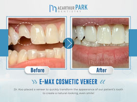 GMedia Dental Marketing & Web Design in Dallas, Fortworth - ad campaign, brand identity, brand management, business card, digital marketing, email marketing, inbound marketing, local seo, logo design, marketing campaigns, printing design, search engine optimization, social media management, social media marketing, web design, web design agencies, marketing strategy, content marketing, best digital marketing agencies, top digital marketing company, dental marketing