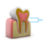 DFW Dental Service in Irving TX 75060 Emergency, Invisalign, Family, Cosmetic, Implants - Dental Implants, Tooth Extraction, Dental Checkup, Cleaning & Examinations, Crowns, Bridges, Implants, Restorations, Veneers, Dentures, Partial Dentures, Emergency Dentist, Invisalign Dentist, Kid Friendly Dentist, Root Canal Therapy