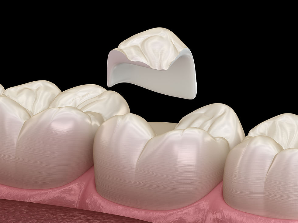 CK Dental City of McKinney TX 75070 Emergency, Invisalign, Family, Cosmetic - Dental Implants, Dental Checkup, Cleaning & Examinations, Crowns, Bridges, Restorations, Veneers, Tooth Extraction, Dentures, Partial Dentures, Teeth Whitening, Emergency Dentist, Invisalign Dentist, Kid Friendly Dentist, Periodontics, Root Canal Therapy