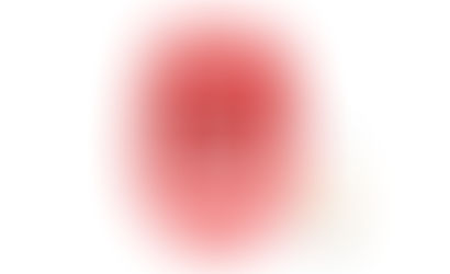 Do You Have Tonsil Stones? Causes, Symptoms & Treatments, With Irving, TX Family & General Dentist