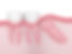 Weekend Emergency Dental in Irving TX 75060 Emergency, Invisalign, Family, Cosmetic, Implants - Dental Implants, Tooth Extraction, Dental Checkup, Cleaning & Examinations, Crowns, Bridges, Implants, Restorations, Veneers, Dentures, Partial Dentures, Emergency Dentist, Invisalign Dentist, Kid Friendly Dentist, Root Canal Therapy