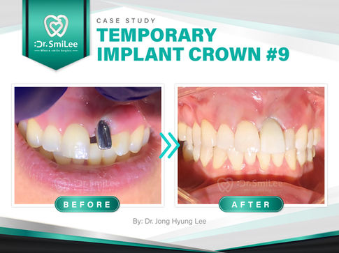 Dr. SmiLee Dental of Waco, TX 76710 Medicaid, Dental Implant, Family and Emergency Dentistry - Medicaid Dentist, Dental Implants, Kid Friendly Dentist, IV Sedation, Invisalign, Crown, Wisdom Tooth Extractions, Dentures, Dental Checkup & Cleaning, Oral Cancer Screening, Inlays and Onlays, Bridge, Esthetic Filling, Tooth Bonding, Teeth Whitening, Veneers, Root Canal Therapy