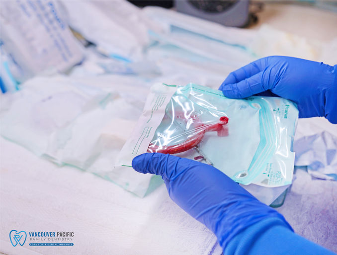 Vancouver Pacific Family Dentistry, WA 98665 Cosmetic Dentistry, Dental Implants - Dental Checkups, Dental Cleaning, Examinations, Crowns, Bridges, Implants, Restorations, Inlays, Onlays, Veneers, Laminates, Bonding, Fillings, Teeth Whitening, Smile Makeover, Tooth Extractions, Wisdom Tooth, Kid Friendly Dentist, Pediatric Dentist, Periodontics, Root Canal Therapy, Oral Cancer Screening, Night Guards for TMJ, Toothaches, Fluoride Treatments, Special needs dentistry