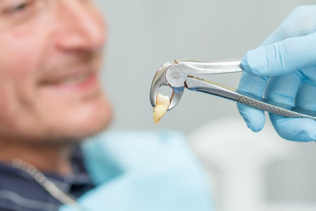 How To Avoid Dry Socket After Tooth Extraction -- With Family & General Dentist in Fort Worth, TX