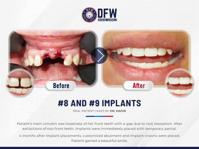 GMedia Dental Marketing & Web Design in Dallas, Fortworth - ad campaign, brand identity, brand management, business card, digital marketing, email marketing, inbound marketing, local seo, logo design, marketing campaigns, printing design, search engine optimization, social media management, social media marketing, web design, web design agencies, marketing strategy, content marketing, best digital marketing agencies, top digital marketing company, dental marketing