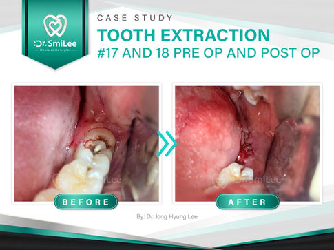 Dr. SmiLee Dental of Waco, TX 76710 Cosmetic Family Emergency - Medicaid Dentist, Dental Implants, Kid Friendly Dentist, IV Sadetion, Invisalign, Crown, Wisdom Tooth Extractions, Dentures, Dental Checkup & Cleaning, Oral Cancer Screening, Inlays and Onlays, Bridge, Esthetic Filling, Tooth Bonding, Teeth Whitening, Veneers, Root Canal