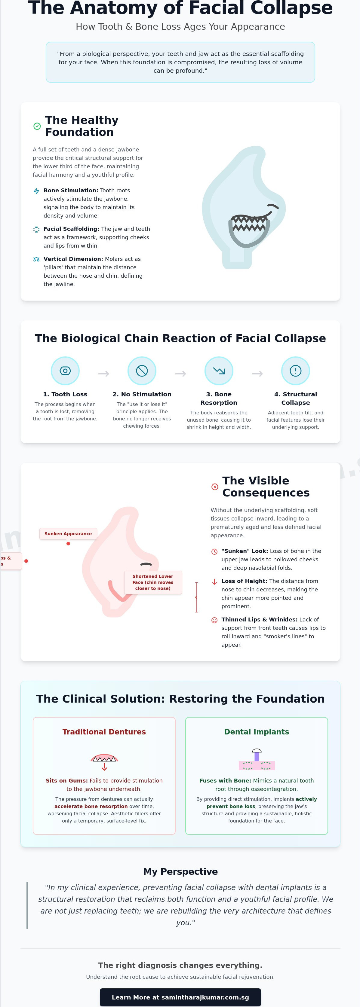 Preventing facial collapse with dental implants
