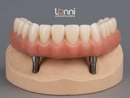 Prótese Protocolo: o sorriso fixo que devolve sua confiança em Guaramirim