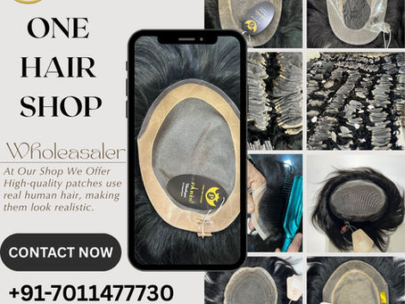 Permanent Hair Patch Solution in Delhi