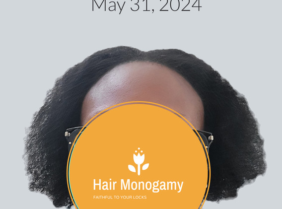 Hair Growth Treatments