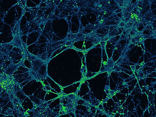 IHC staining 1_Image082_ch00.jpg