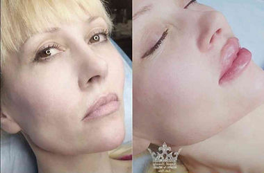 Kobieta przed i po makijażu permanentnym ust, widoczny efekt. Polskie Firmy w IE