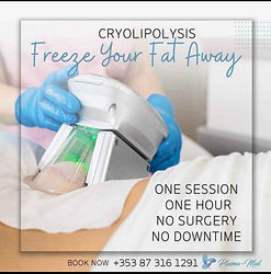 Cryolipolysis freezes fat away effectively, one session, one hour, no surgery, Plasma-Med Dublin