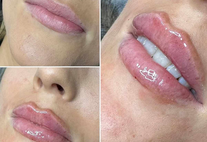 Aesthetic Treatments